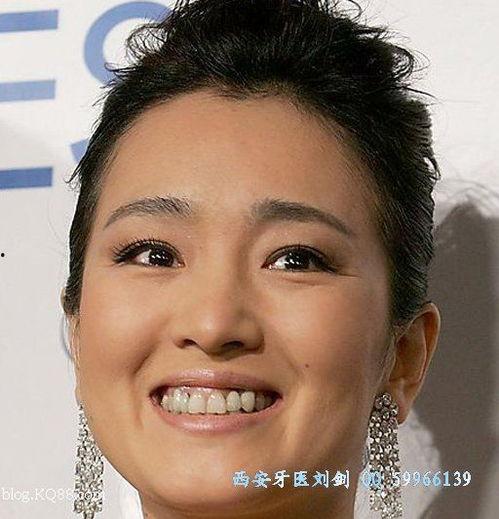 牙明星,闪耀口腔护理新篇章