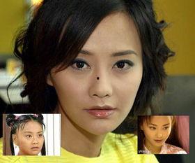 开眼角的明星对比照片,揭秘眼部整形魅力瞬间