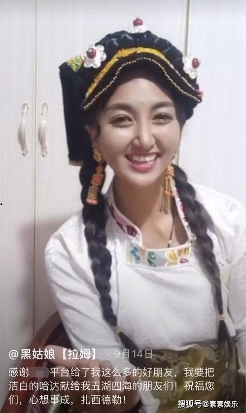 网红拉姆遭火烧伤,网红拉姆不幸遭火烧伤，网络暴力何时休？