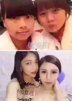 网红垫鼻梁,揭秘整形潮流背后的秘密