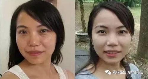 徒手祛斑爆料视频,视频爆料让你轻松告别斑点困扰